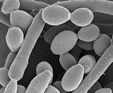 candida albicans